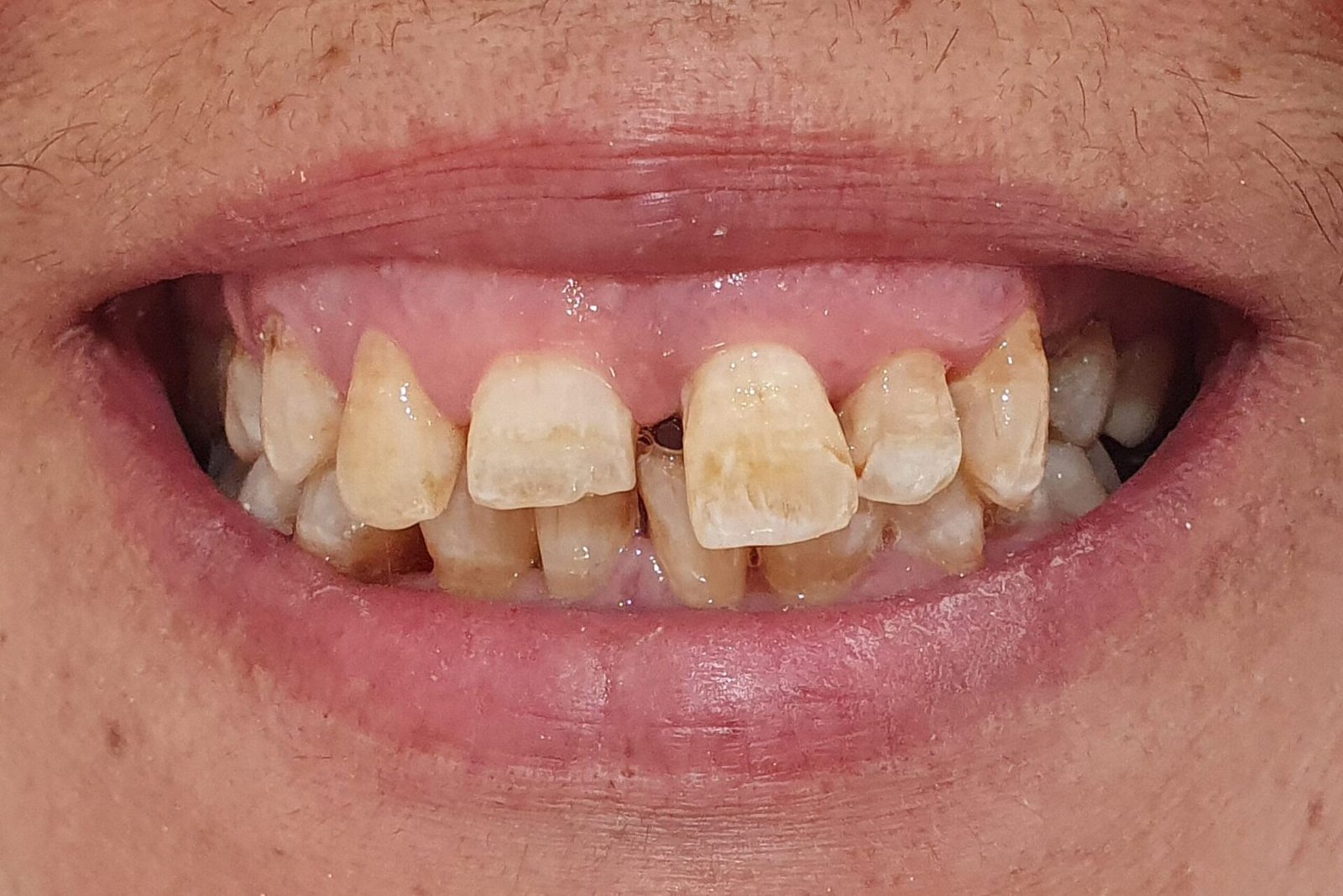 Before image