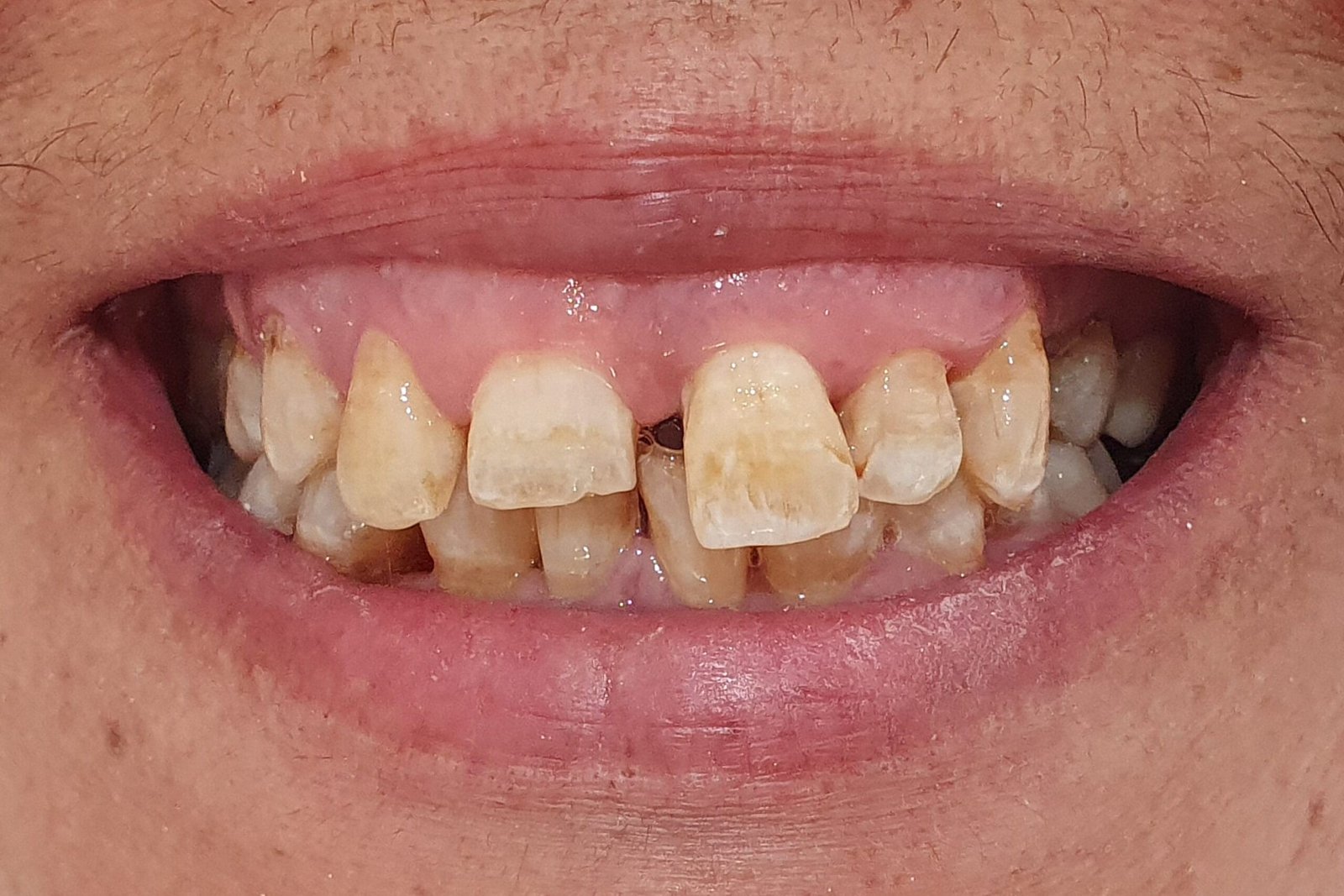 Before image