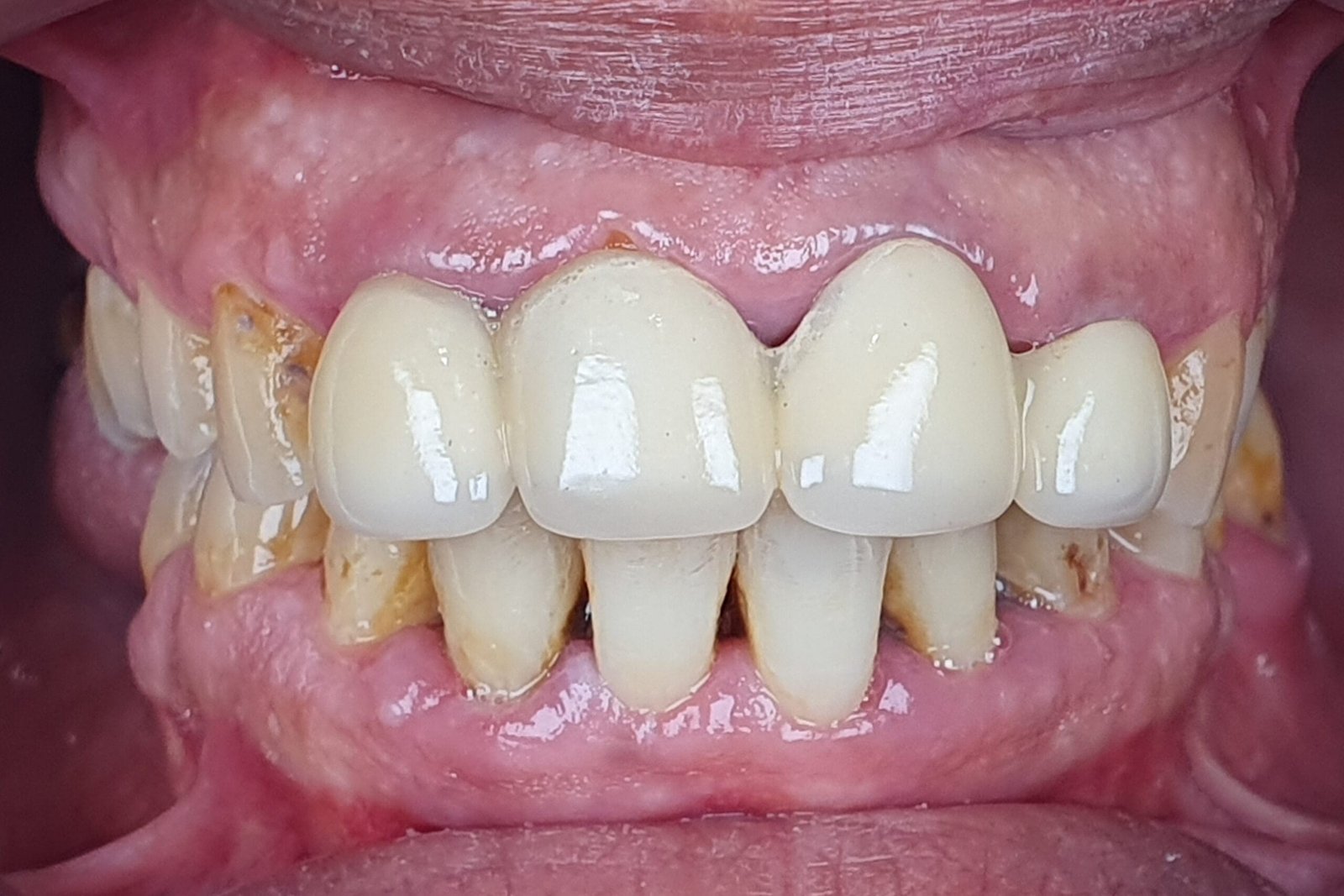 Before image