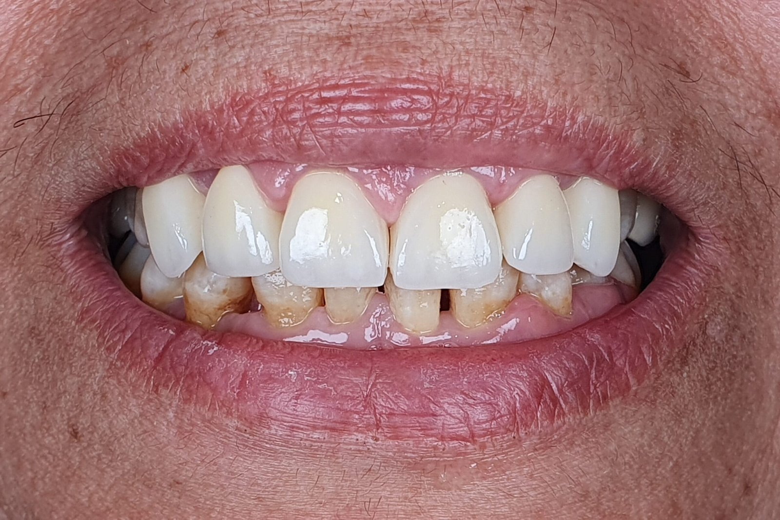 After image