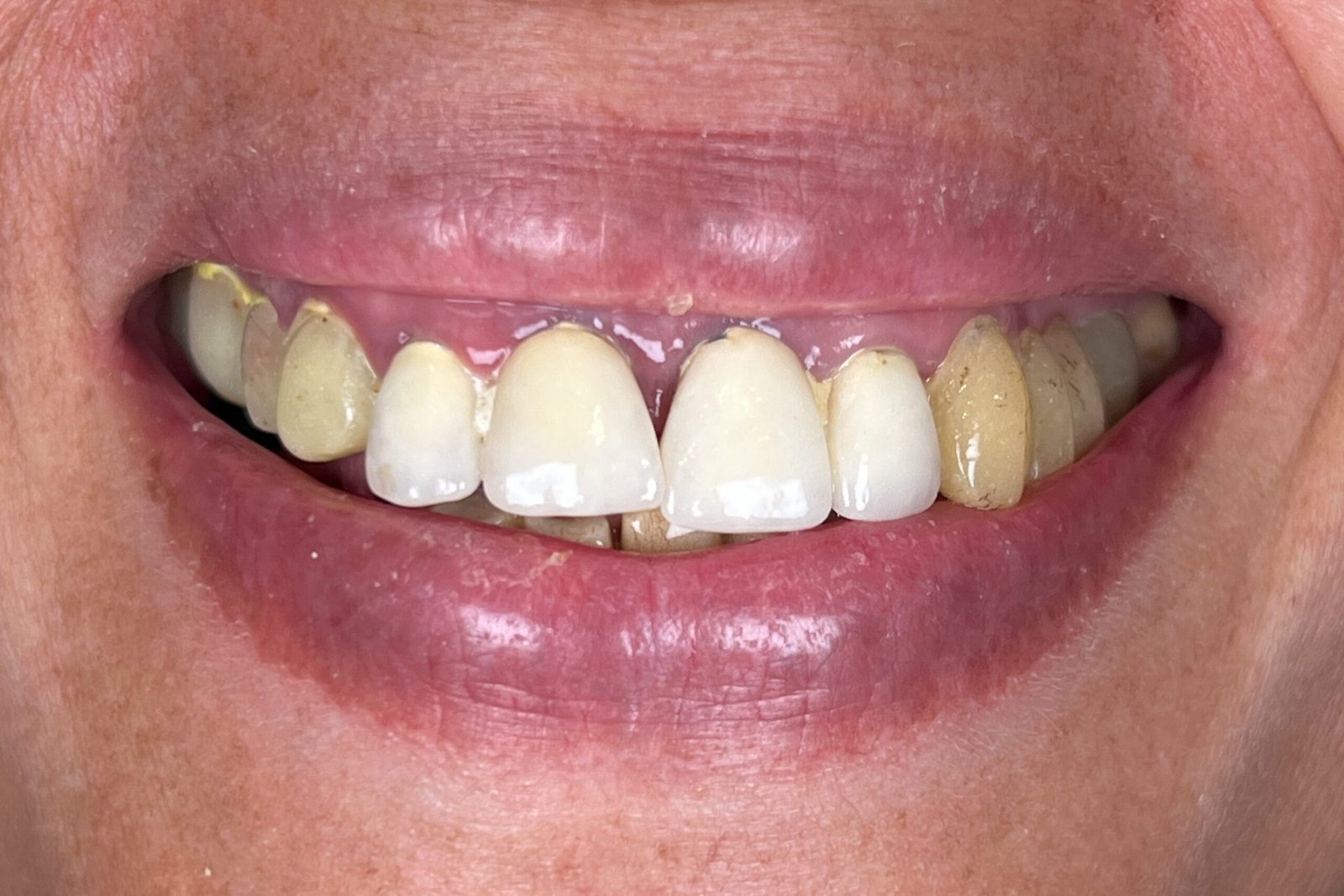 Before image