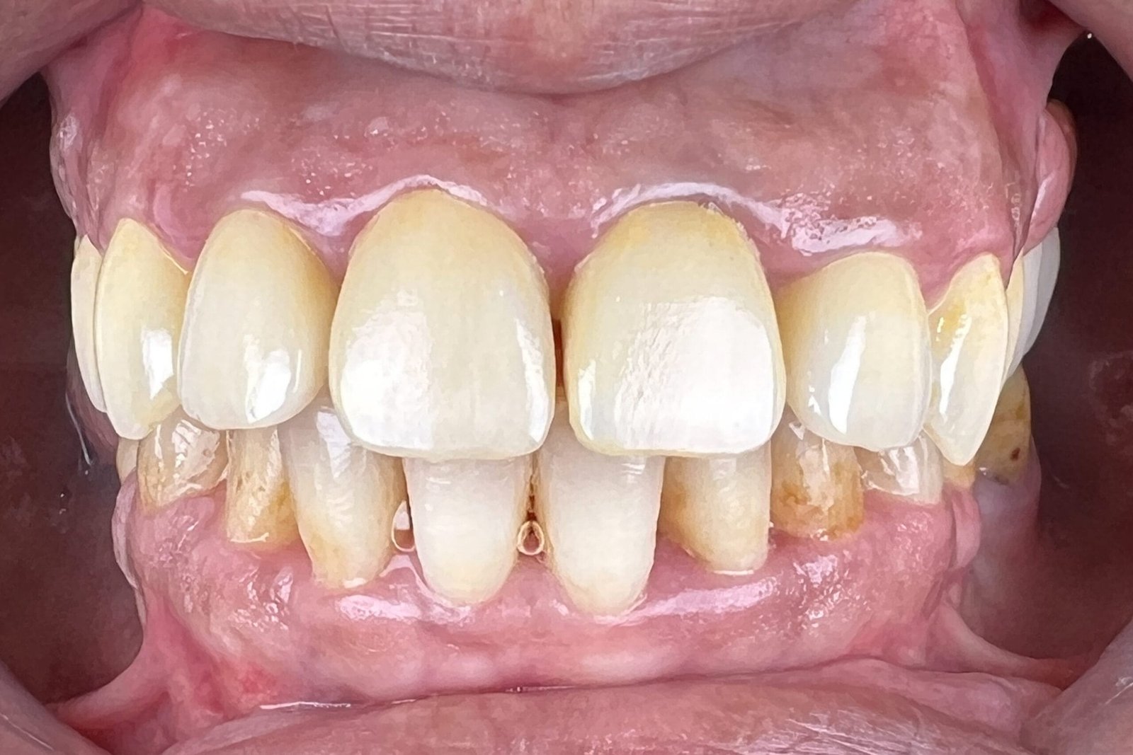 After image