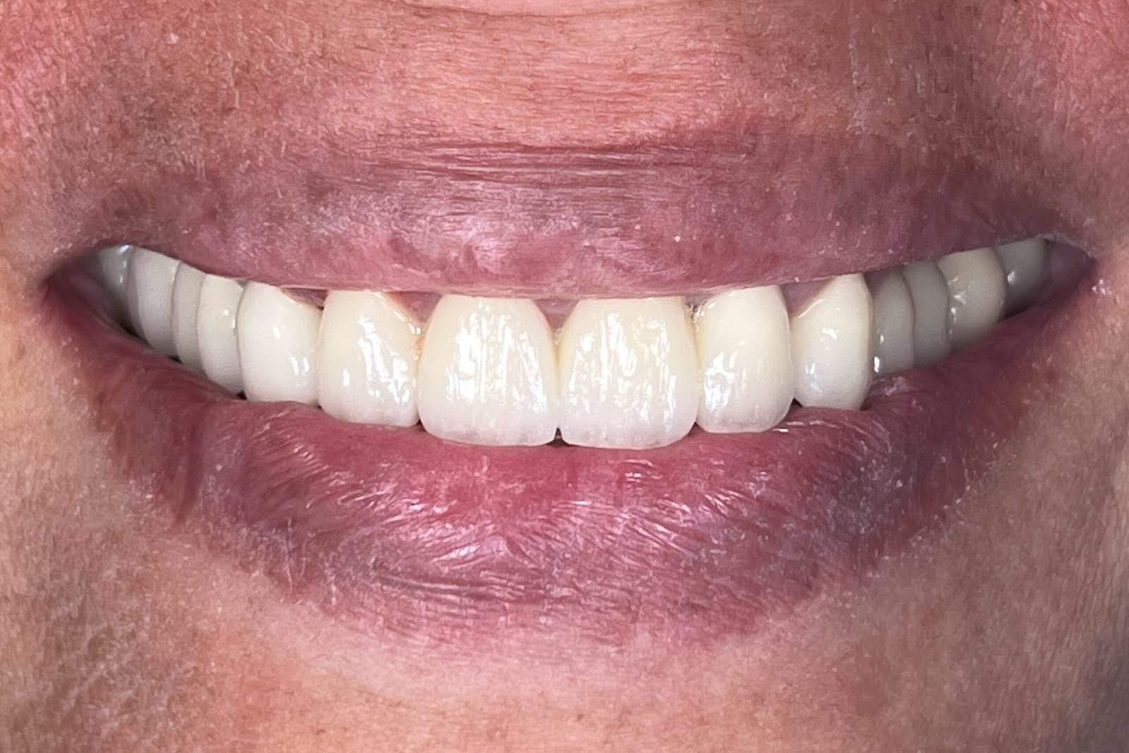 After image
